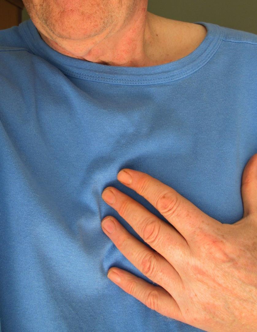Arritmia cardíaca pode causar AVC isquêmico se não tratada