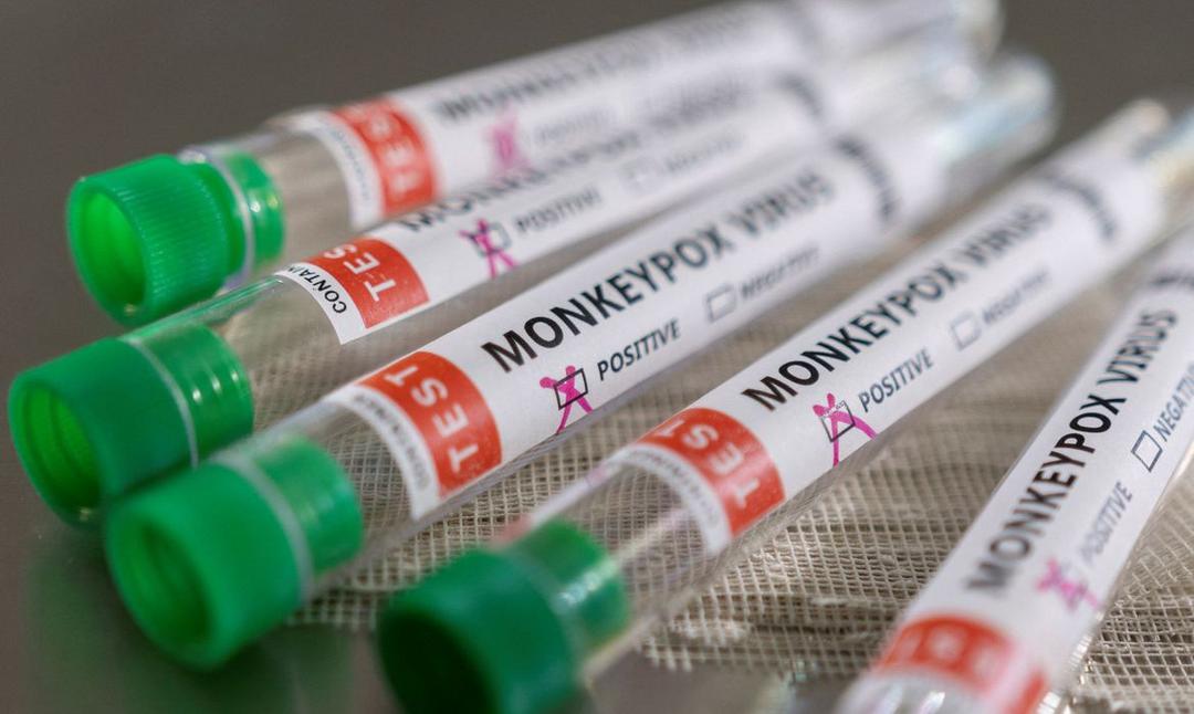 Sinepe/PR divulga cartilha de prevenção ao vírus monkeypox nas escolas