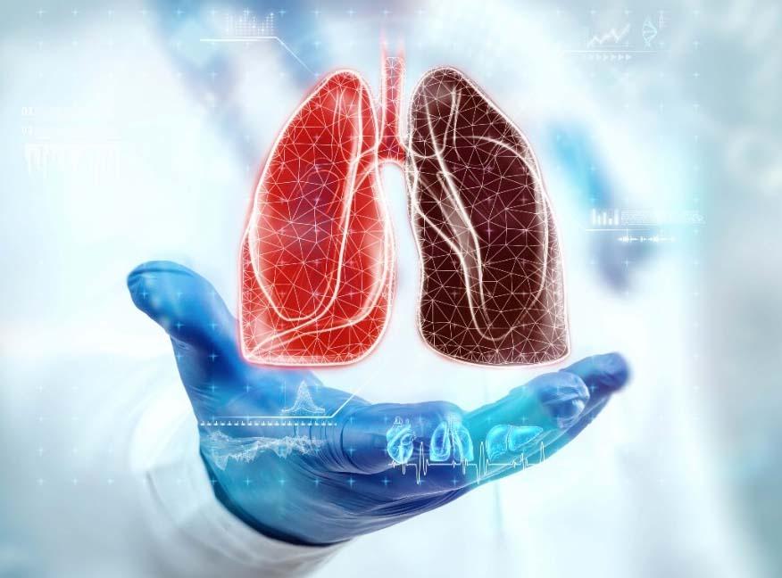 Previna-se: câncer de pulmão é um dos mais comuns no Brasil