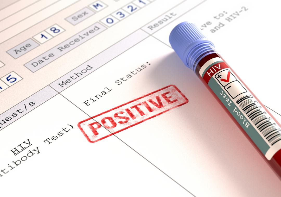 Com nova variante, mais transmissível e agressiva, especialistas alertam sobre o diagnóstico precoce do HIV