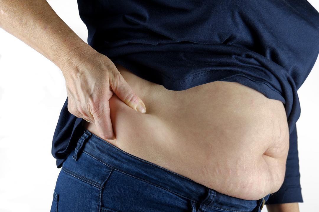 Alimentação inadequada, estresse e estilo de vida podem levar à obesidade